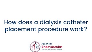 How does a dialysis catheter placement procedure work [upl. by Cartwright785]