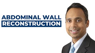 Abdominal Wall Reconstruction with Dr Tushar Patel [upl. by Ferri]