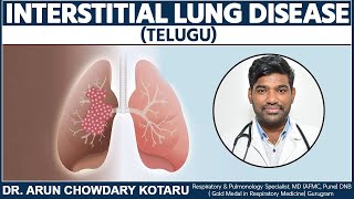 Interstitial Lung Disease TELUGU  Dr Arun Chowdary Kotaru [upl. by Aramois]