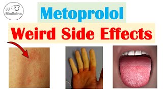 Metoprolol amp Beta Blockers Weird Side Effects Skin Gastrointestinal Psychological [upl. by Mella506]