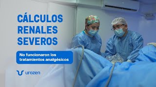 ¡Cuando los farmacos no funcionan eliminamos los cálculos renales con Láser Holimun 👨🏻‍⚕️🪨 [upl. by Sigsmond]