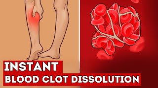 These 7 FOODS Instantly Dissolve Blood Clots in Your Vessels [upl. by Najed]