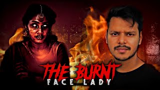 Lady with the Burnt Face  Real horror story [upl. by Dranek]