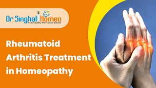 Homeopathic Treatment for Rheumatoid Arthritis  Dr Vikas Singhal HomeoDoctor [upl. by Allemap]