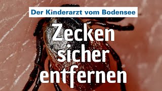 Zecken sicher entfernen – Der Kinderarzt vom Bodensee [upl. by Airetal]