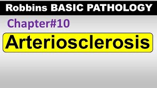 Ch10  Arteriosclerosis  Blood Vessel Pathology  Robbins Lectures [upl. by Feldt]