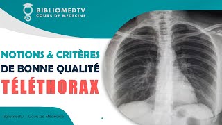 Radiographie du Thorax  Notions et Critères de Bonne Qualité [upl. by Cordy400]