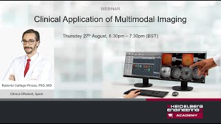 Recorded webinar Clinical Application of Multimodal Imaging [upl. by Nakhsa]