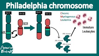 Philadelphia chromosome  Chromosome 9 to 22 translocation  BCRABL translocation CML pathology [upl. by Jameson]