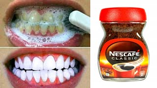 How to Whiten Your Teeth Naturally in 1 Minute teeth whitening at home [upl. by Stent]