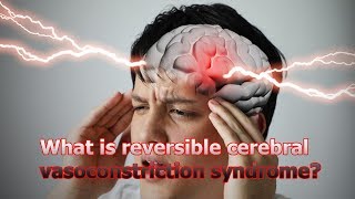 Health information WHAT Í REVERSIBLE CEREBRAL VASOCONSTRICTIONS SYNDROME [upl. by Justine]