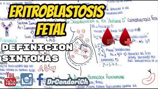 Eritroblastosis Fetal Incompatibilidad Rh ¿Que es¿como sospechar [upl. by Bisset]