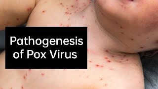 Pathogenesis of Pox Virus [upl. by Halford56]