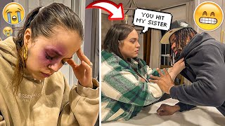 Shane Gave Me A Bruise AND MY SISTER LOST IT Prank Gone Extremely Wrong [upl. by Conrad233]