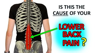 Recurrent Lower Back Pain The Research Says… Do This [upl. by Alaj434]