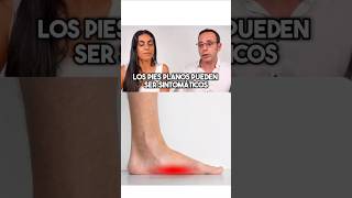 Pie plano Dolor de Rodilla Dolor de Cadera Pieplano dolorderodilla fisioterapia shorts [upl. by Htrag]