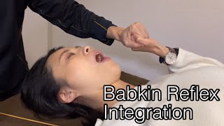 Reflex treatment for Babkin reflex [upl. by Prochoras]