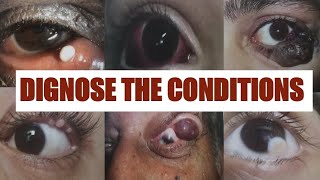 PATHOLOGICAL EYE CONDITIONS 1 Ophthalmology Osce [upl. by Worthy]