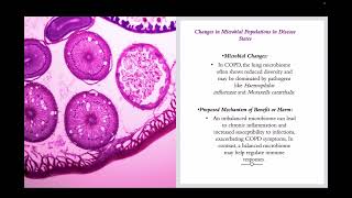 COPD Microbiome [upl. by Joyce]