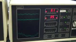 Cardiac Rehab Stretching Cooldown With Cardiac Telemetry [upl. by Nosdivad296]