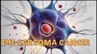 Understanding Sarcoma Cancer Causes Prevention and Remedies [upl. by Ardnuahsal]