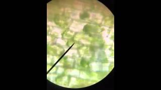 Plasmolyzed Plant Cells Return to Normal Turgidity [upl. by Akinohs]