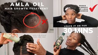 Indian hair growth oil on natural hair  Dabur Amla oil Treatment [upl. by Ainalem]