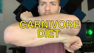 Psoriasis After 120 Days on a Carnivore Diet [upl. by Aratak]