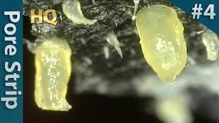 4 Pore Strip Close up  Blackheads Removal  毛穴パックで角栓を除去 [upl. by Anirres]