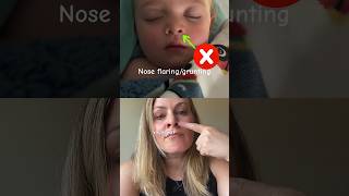 What does CROUP sound like amp Home Treatment for Croup [upl. by Eilac]