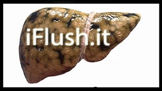 ♥ ♥ ♥ FATTY LIVER ENZYMES ♥ ♥ ♥ Serrapeptase The Super Enzyme ♥ [upl. by Yovonnda]