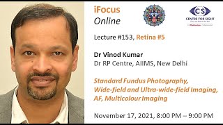 iFocus Online 153 Retina 4 Dr Vinod Kumar Fundus Photography and AF [upl. by Beffrey]