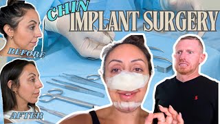 Chin Implant and Deviated Septum Surgery Results My Honest Review [upl. by Waldman604]