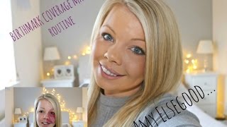 BIRTHMARK COVERAGE MAKE UP TUTORIALAMY ELSEGOODFIRST VIDEO [upl. by Maguire]