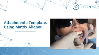 Attachments Template Using Matrix Aligner [upl. by Kellie]