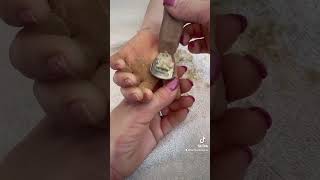 Removing callus from kid hands  Keratoderma hyperkeratosis EPPK skin shaving callous  Apr 2 2023 [upl. by Eetnwahs167]