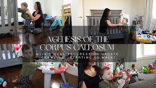 Agenesis of the Corpus Callosum  Mila’s HUGE PROGRESSION UPDATE  Crawling  Starting to WALK [upl. by Placida]