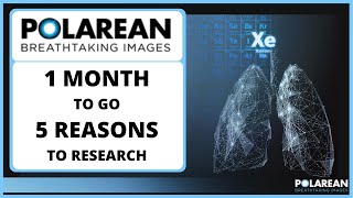 Polarean Imaging 1 Month to go 5 Reasons to Research [upl. by Eylrahc]