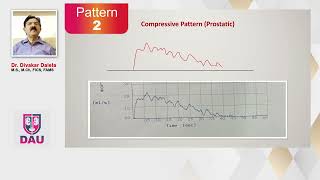 Uroflowmetry How to interpret Flow Patterns [upl. by Assilen264]