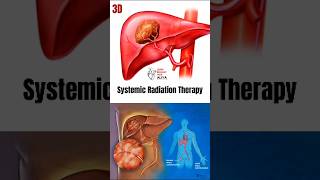 Systemic Radiation Therapy  animation 3d short  learn Biology with Aliya [upl. by Wylde715]