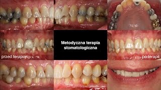 Metodyczna terapia stomatologiczna [upl. by Sheng]