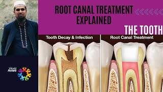 Root Canal Treatment Explained DentalDigest DEVKeFacts viralhog [upl. by Olivia]