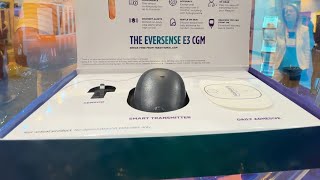 Eversense The 180day Implantable CGM  CEO Interview [upl. by Barris]