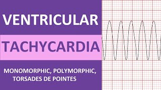 Ventricular Tachycardia Vtach ECG Interpretation Treatment Nursing NCLEX Review [upl. by Alehtse]