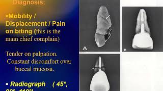 Fall 2020  Endodontics 3  Lec 9  Traumatic dental injuries Part 2 [upl. by Absalom]