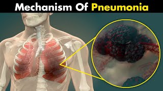 The Mechanism Of Pneumonia  3D Animation UrduHindi [upl. by Monia]