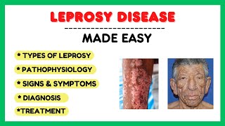 Leprosy hansen disease classification symptoms diagnosis treatment [upl. by Yreffoeg517]