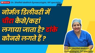 नोर्मल डिलीवरी में चीरा कैसेकहां लगाया जाता है टांके कौनसे लगते हैं episiotomy gynecologist [upl. by Ahsemat]