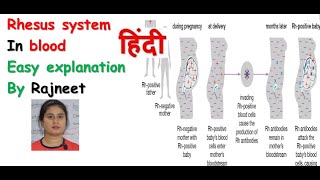 Rhesus system in hindi  Rh incompatibility  haemolytic disease  Rj medical education [upl. by Tobin]