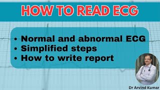 Mastering ECG Reading  Simplified Guide for Interns General Practitioners and Medicine Residents [upl. by Ahsenrat]